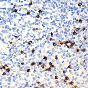 CD19 Polyclonal Antibody