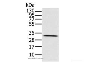 HSD17B8 Polyclonal Antibody