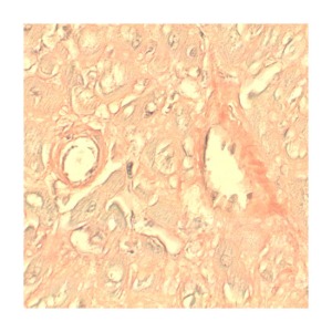 Amyloid Stain Kit (Congo Red)