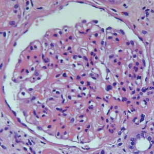 Gill’s Hematoxylin #3, triple strength for Histology