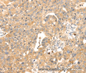 S100A12 Polyclonal Antibody