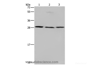 TP53INP1 Polyclonal Antibody