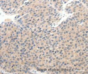SCN10A Polyclonal Antibody